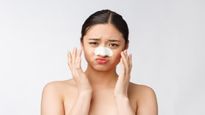 ब्लैकहेड्स से छुटकारा पाने के लिए यूज करें DIY पोर स्ट्रिप्स, स्किन भी करेगी ग्लो