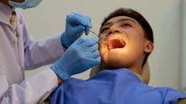 World Oral Health Day 2023: खराब ओरल हेल्थ के कारण हो सकती हैं ये गंभीर बीमारियां