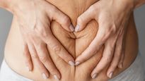 Stretch Marks: प्रेग्नेंसी के दौरान स्ट्रेच मार्क्स होने से कैसे रोकें? जानिए नेचुरल तरीके