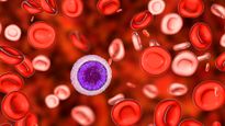 World Thalassemia Day 2023: जानिए विश्व थैलेसीमिया दिवस का इतिहास,  थीम और लक्षण और सावधानियां