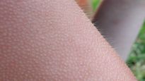 Goosebumps Causes: डर या ठंड लगने पर अचानक क्‍यों खड़े हो जाते हमारे रोंगटे, कभी आपने सोचा है? 
