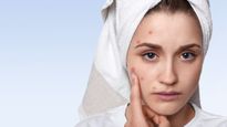Pimple Popup Tips : पार्टी में जाने से रोक रहा है पिंपल, स्टेप-बाय-स्टेप इस तरह करें पॉप अप