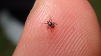 Powassan Virus: पॉवासन वायरस ने बढ़ाई चिंता, जानिए क्या हैं इसके लक्षण और बचाव 