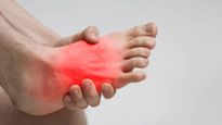 Guillain-Barré Syndrome: इस खतरनाक बीमारी में लकवे में बदल जाती है पैरों की झुनझुनी, जान‍िए लक्षण और इलाज 