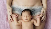 Myths vs Facts: सी-सेक्शन के बाद कम नहीं होता है पेट? जानें इससे जुड़े कुछ आम मिथ और फैक्ट्स