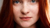 Skin Care Tips : झाइयों ने कम कर दी चेहरे की खूबसूरती, इस घरेलू उपाय से स्किन का खोया निखार पाए वापस