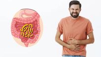 आंतों में चिपके कीड़े चूस लेंगे सारा खून, एनिमिया और पेट फूलने की समस्‍या से बचने के ल‍िए करें ये घरेलू उपाय 