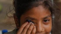 Eye Flu Repeat : दूसरी बार आ गई आंख! दोबारा न हो आईफ्लू इसल‍िए ये गलती करने से बचें  