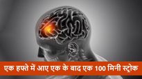  नस में ब्‍लॉकेज की वजह से इस शख्‍स को आए हफ्तेभर में 100 मिनी स्ट्रोक, जानें कैसे बचाई जान 