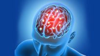 World Stroke Day 2023: एक नहीं तीन तरह के होते हैं स्ट्रोक,  सर्दियों में भूलकर भी न करें ये काम 