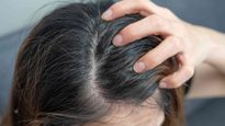 प्रेग्नेंसी में सिर खुजा-खुजाकर हो गई हैं पागल, तो जान लें इसकी वजह