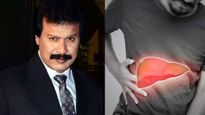  ल‍िवर डैमेज से CID के 'फ्रेडी' दिनेश फडनीस की हुई मौत, ल‍िवर को हेल्‍दी बनाए रखने के ल‍िए करें ये काम 