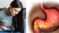 Cold and Gassy Stomach : सर्दियों में क्‍यों बनती है पेट में ज्‍यादा गैस, जानें इसके पीछे का साइंस
