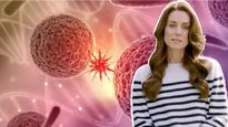 Princess Kate Middleton की चल रही है प्रिवेन्टिव कीमोथेरपी, कैंसर मरीजों को क्‍यों दी जाती है ये थेरेपी?