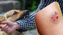  महाराष्‍ट्र में आवारा कुत्ता काटने के एक महीने बाद महिला की हुई मौत, रेबीज के लक्षण और बचाव जानें 