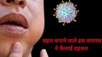 Mumps Virus: राजस्‍थान में फैला इस खतरनाक वायरस का कहर, बड़े-बच्‍चे हो रहे शिकार, जानें क्‍या हैं ये नई आफत 