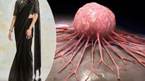  Saree Cancer : इस तरह साड़ी पहनने से हो सकती है ये खतरनाक बीमारी, साड़ी कैंसर के लक्षण और बचाव जानें 