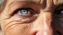 Macular Degeneration:  20 करोड़ लोगों को है आंखों की यह लाइलाज बीमारी,  जानें इसके बारे में सबकुछ  