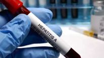  World Hepatitis Day 2024: बारिश में क्यों बढ़ जाते हैं हेपेटाइटिस के मामले, जानें इससे बचने के उपाय 