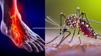 सावधान! बिहार में अब फैला 'लंगड़ा बुखार',  डेंगू-चिकनगुनिया से भी ज्यादा है खतरनाक, जानें Lame Fever के लक्षण