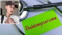  24 साल की ऑस्ट्रेलियाई टिकटॉकर की  इस दुलर्भ 'लाइलाज'  कैंसर से हुई मौत, जानें क्‍या है रबडोमायोसारकोमा?