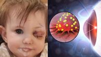  मामूली सा दिखने वाला सूजन निकला खतरनाक कैंसर,  छीन ली 1 साल की बच्ची की आंखों की रोशनी, ये है लक्षण 