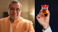 15 द‍िन पेशाब पीकर जोड़ी टूटी हुई हड्डी, एक्‍टर परेश रावल का दावा, कैसे काम करता है यूरिन थेरेपी? 