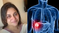  Liver Tumor से जूझ रही हैं दीपिका कक्कड़,  करानी होगी सर्जरी, क्‍या है इस बीमारी की वजह और लक्षण? 