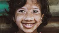 World Vitiligo Day 2025: सफेद दाग नहीं, चेहरे की पहचान हैं ये, जानिए कैसे ये चेहरे बने समाज के लिए मिसाल