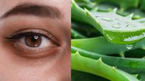  Dark Circle Remedy : क्या वाकई रातभर एलोवेरा लगाने से डार्क सर्कल्स हो जाते हैं गायब? ऐसे करें इस्‍तेमाल 