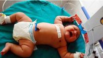 MP में जन्मा 5.4 किलो का शिशु! पेट में बच्चे का वजन कैसे बढ़ता है? ऐसे बच्चों को हो सकती है ये गंभीर बीमारी