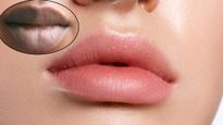 च‍िपच‍िपी उमस वाली गर्मी में काले पड़ गए हैं होंठ? इन घरेलू उपायों से पाएं पिंक और सॉफ्ट-सॉफ्ट लिप्स