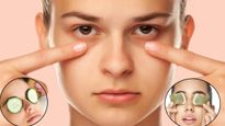 Home Remedies For Dark Circles: डार्क सर्कल्स को कहें बाय-बाय, इन 7 घरेलू उपायों से आंखों की खूबसूरती लौटाएं