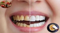 Teeth Whitening At Home: बिना डेंटिस्ट के पाएं चमचमाते सफेद दांत, आजमाएं ये 7 आसान घरेलू नुस्खे