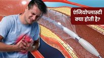 हार्ट अटैक के खतरे को कम करने में कारगर है एंजियोप्लास्टी, जानें कब पड़ती है इसकी जरूरत और कितना आता है खर्च