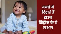 नवजात शिशु में ये लक्षण हैं डाउन सिंड्रोम का संकेत, डॉक्टर से जानें क्यों होती है ये बीमारी