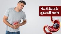 पेट में दर्द, मतली समेत ये 5 लक्षण पेट में कैंसर का हो सकते हैं संकेत , नजरअंदाज करने की न करें भूल