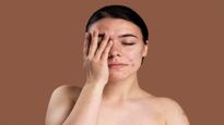 चेहरे से पिंपल्स हटाने के लिए आजमाएं ये 5 घरेलू उपाय, मिलेगी बेदाग त्वचा