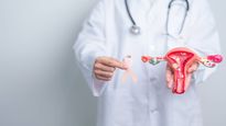 World Ovarian Cancer Day 2026: ओवेरियन कैंसर से बचने के लिए महिलाएं करें ये काम, डॉक्टर ने बताए बचाव के तरीके