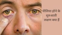  पीलिया के इन लक्षणों को न करें मामूली समझने की भूल, लिवर फेलियर तक की आ सकती है नौबत