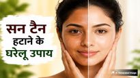सूरज की तपिश से काला पड़ गया है चेहरा? इन 3 देसी नुस्खों से हटाएं जिद्दी सन टैन