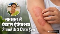 मानसून में खुजली और फंगल इंफेक्शन से बचना है? अपना लें डॉक्टर मनीषा के बताए 3 आसान आयुर्वेदिक उपाय