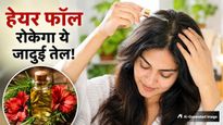 टूटते-झड़ते बालों से हैं परेशान? ट्राई करें गुड़हल और नारियल तेल से बना हेयर ऑयल, रुक जाएगा Hair Fall