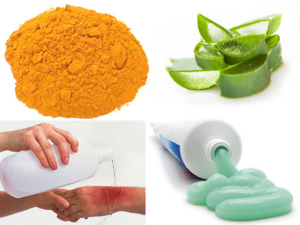 Immediate Burn Remedies At Home 