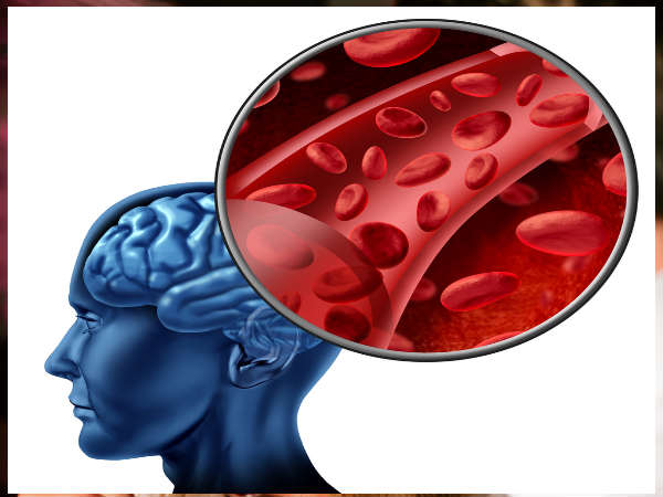 मिथक 2: शराब मस्तिष्क की कोशिकाओं को नष्ट कर देती है