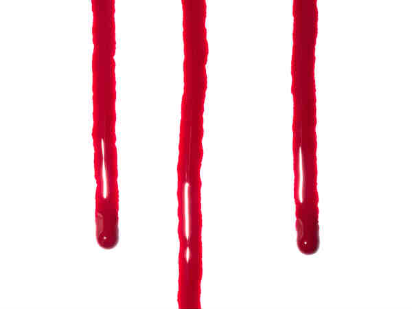 ब्‍लीडिंग 