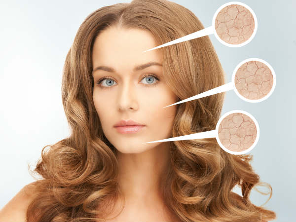 रुखी त्वचा