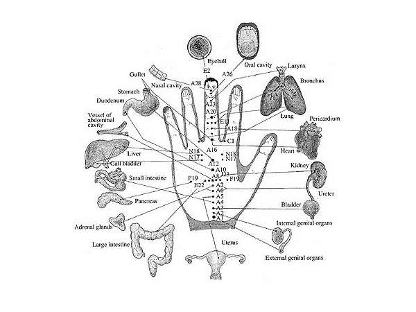 19. एक्‍यूपंक्‍चर