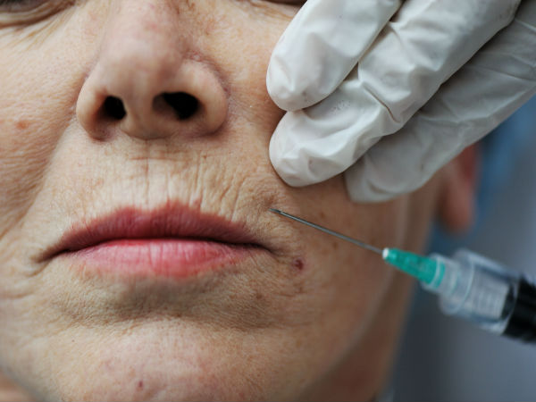  How to Reduce Facial Wrinkles