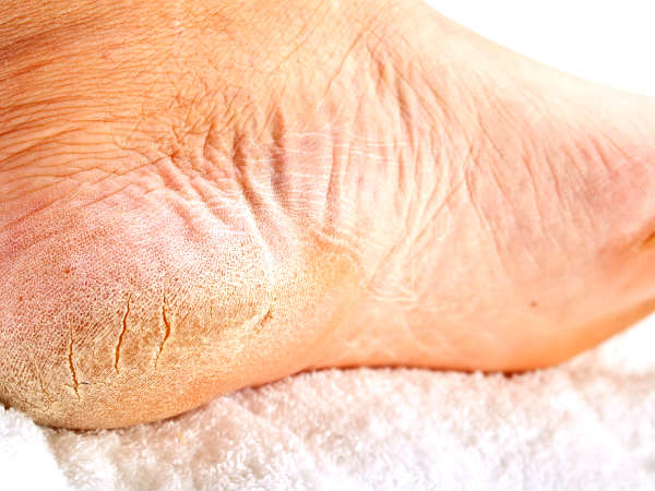 Foot Scrub For Dry Foot 